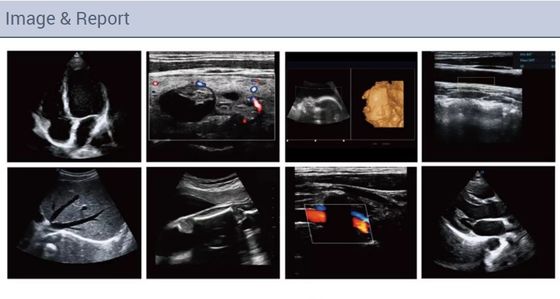 Mesin Pemindai Ultrasound Doppler Kardiovaskular Portabel Penuh Warna