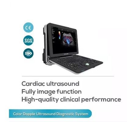 Mesin Pemindai Ultrasound Doppler Kardiovaskular Portabel Penuh Warna