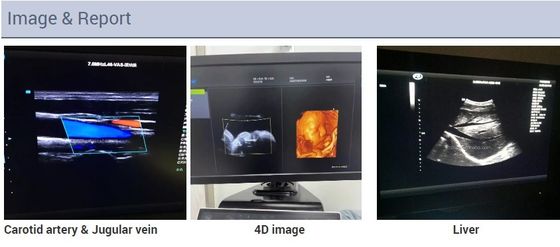 2D 3D 4D Echocardiography Cardiac Trolley Echo Color Doppler Mesin Ultrasound