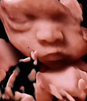 3D 4D 5D Color Doppler Ultrasound Trolley Ultrasound Scanner Untuk OB GYN