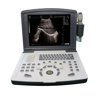 Pemindai Ultrasound Diagnostik Digital Penuh Portabel OEM