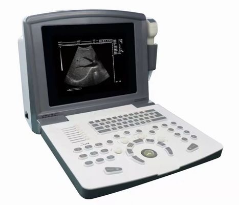 Pemindai Ultrasound Diagnostik Digital Penuh Portabel OEM