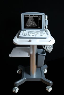 Pemindai Ultrasound Diagnostik Digital Penuh Portabel OEM