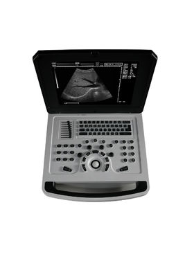 Notebook Black And White Ultrasound Scanner untuk Kardiologi