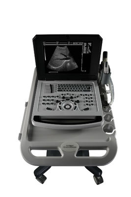 Notebook Black And White Ultrasound Scanner untuk Kardiologi