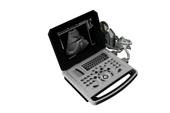 Notebook Black And White Ultrasound Scanner untuk Kardiologi